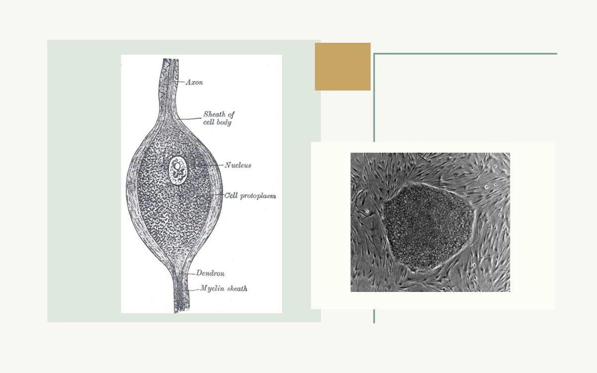 Historical anatomical illustration: nerve cell with axon and cell body · Microscopy of an embryonic stem-cell colony on feeder cells